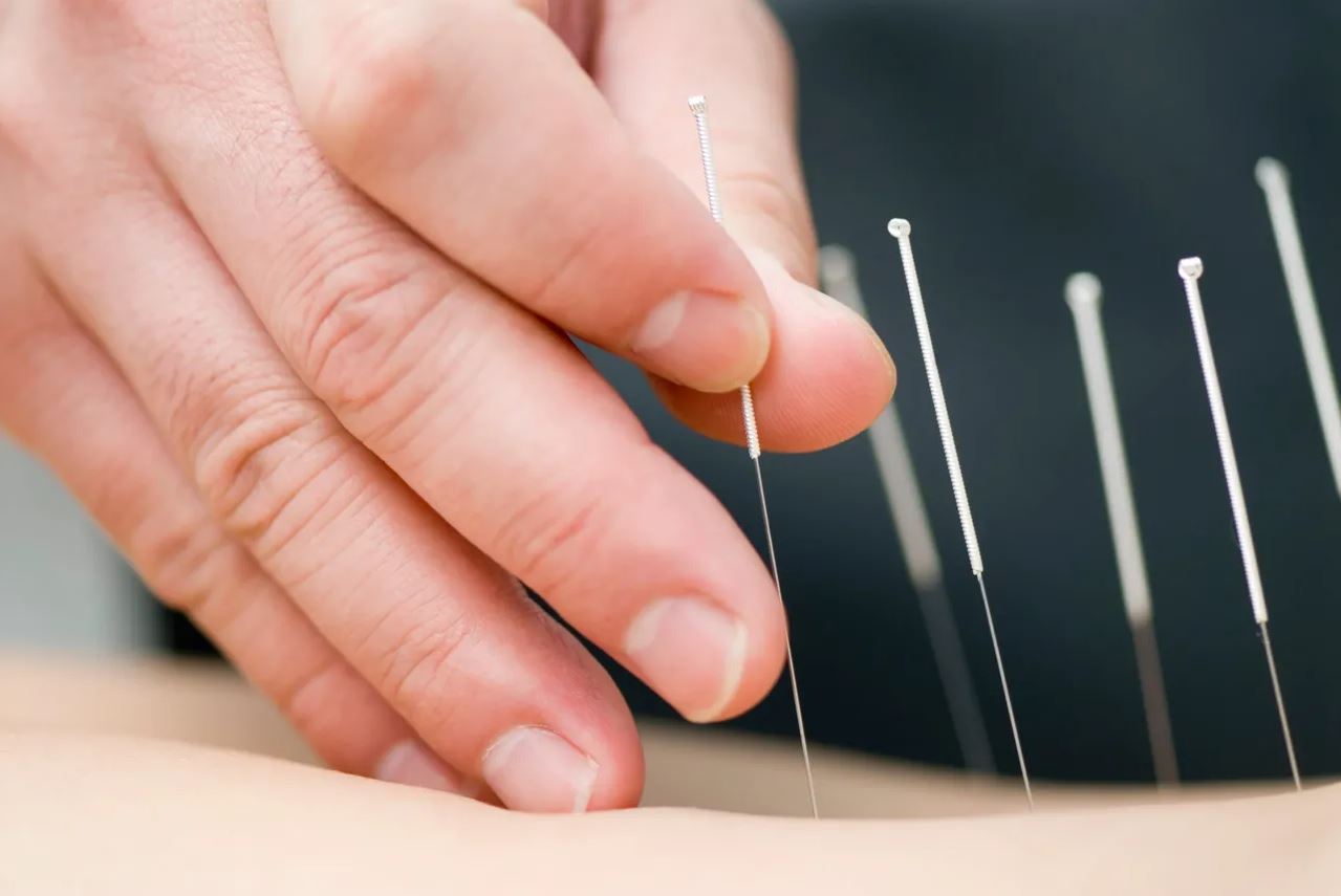 acupuncture close up insert skin